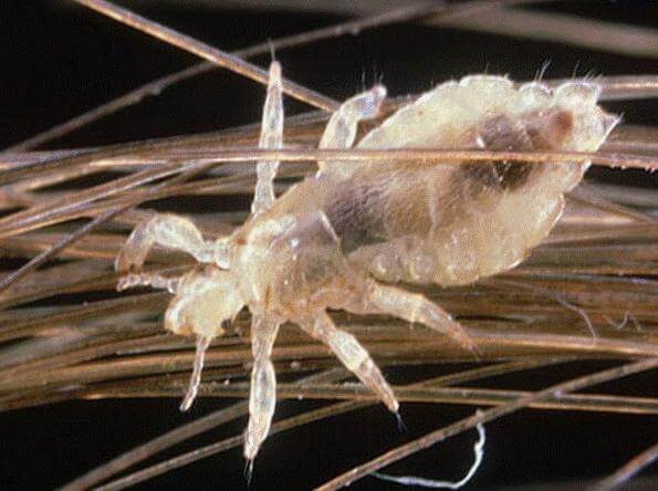 Tất tần tật về con chấy trên đầu người 2