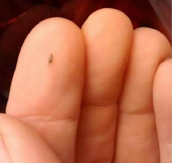 Tất tần tật về con chấy trên đầu người 3